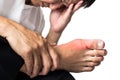 Man with painful and inflamed gout on his foot, around the big toe area Royalty Free Stock Photo