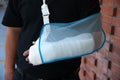 Man with a plaster because broken arm. Royalty Free Stock Photo
