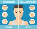 Cosmetic procedures skin care