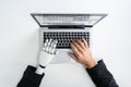 Man With Prosthetic Hand Working On Laptop