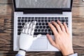 Man With Prosthetic Hand Working On Laptop