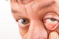 Man pulls his lower eyelid with his finger down Royalty Free Stock Photo