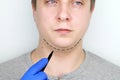 Chin lift - mentoplasty. A man at the reception at the plastic surgeon. Preparation for surgery Royalty Free Stock Photo