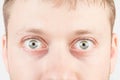 Man's surprised eyes