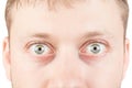 Man's surprised eyes on white