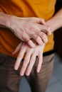 Man scratch oneself, dry flaky skin on hand with psoriasis vulgaris, eczema and other skin conditions like fungus, plaque, rash Royalty Free Stock Photo