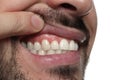 Man showing healthy gums on white background, closeup Royalty Free Stock Photo