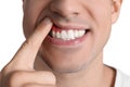Man showing inflamed gums on white background, closeup Royalty Free Stock Photo