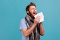 Man sneezing in napkin, cleaning running nose and coughing, suffering influenza symptoms, fever. Royalty Free Stock Photo