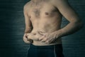 Man squeeze belly fat on dark background. Early stage of obesity. An adult male squeezes a fold of fat on his stomach. The problem Royalty Free Stock Photo