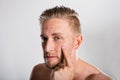 Man Squeezing Pimple On His Face Royalty Free Stock Photo