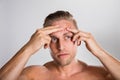 Man Squeezing Pimple On His Forehead Royalty Free Stock Photo