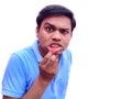 Man suffer from mouth ulcer on lips also known as aphthae painfull feeling