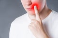 Man suffering from herpes virus on the lip, studio shot on gray background