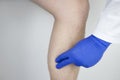 A man suffers from pain in the calves. Stretching the calf muscle, varicose veins, leg cramps, or myositis. Orthopedic doctor
