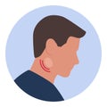 Man with swollen lymph nodes