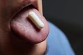 Man taking pill, mouth open with tongue sticking out. Royalty Free Stock Photo