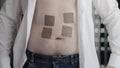 A man with an unbuttoned shirt and many anti-tobacco patches glued to his stomach. Harm of smoking, bad habit. Treatment