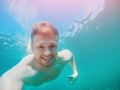 Man under water in turquoise sea. concept of pain from bite jellyfish Royalty Free Stock Photo