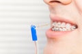 Man using interdental brush for orthodontic braces Royalty Free Stock Photo