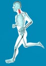 Man walking seen on x-ray with pain in the cervical vertebrae Royalty Free Stock Photo