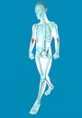 Man walking seen on x-ray with pain in elbows Royalty Free Stock Photo