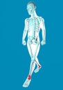 Man walking seen on x-ray with pain in feet Royalty Free Stock Photo