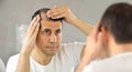 Man watching his hair loss Royalty Free Stock Photo