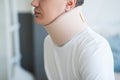 Man wearing a neck brace, orthopedic bandage, hernia of the cervical spine, health problems Royalty Free Stock Photo