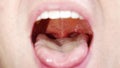 a man's mouth close-up. the palatine uvula and mucous membrane of the throat.