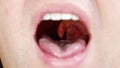 a man's mouth close-up. the palatine uvula and mucous membrane of the throat.