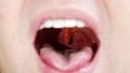 a man's mouth close-up. the palatine uvula and mucous membrane of the throat.