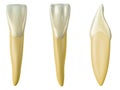 Mandibular central incisor tooth in the buccal, palatal and lateral views. Realistic 3d illustration of mandibular central incisor