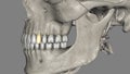 The mandibular first premolar has a bulkier crown compared to the cuspid, yet its root is more slender and shorter