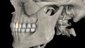 The mandibular first premolar has a bulkier crown compared to the cuspid, yet its root is more slender and shorter