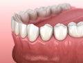 Mandibular human gum and teeth anatomy. Medically accurate tooth