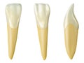 Mandibular lateral incisor tooth in the buccal, palatal and lateral views. Realistic 3d illustration of mandibular lateral incisor