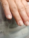 Manicure , onycholysis , gel Royalty Free Stock Photo