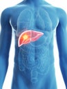 A mans liver cancer Royalty Free Stock Photo