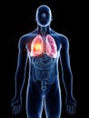 A mans lung cancer Royalty Free Stock Photo