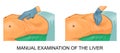 Manual examination of the liver