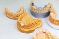 The manufacture of dental implants. Modeling and restoration of lost teeth in a dental laboratory