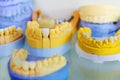 Manufacturing of dental implants. Dummies of the jaw with teeth for the formation of the oral cavity. Close-up