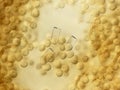 Many spores of a slime mold. Microscopy