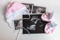 Many ultrasound pictures and clothes for baby girl. Expecting in pregnancy