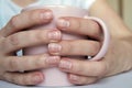 Many white spots on fingernails Leukonychia due to calcium deficiency or stress, hands holding mug Royalty Free Stock Photo