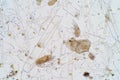Marine aquatic plankton under microscope view