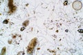 Marine aquatic plankton under microscope view Royalty Free Stock Photo