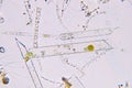 Marine aquatic plankton under microscope view Royalty Free Stock Photo