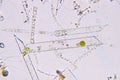 Marine aquatic plankton under microscope view